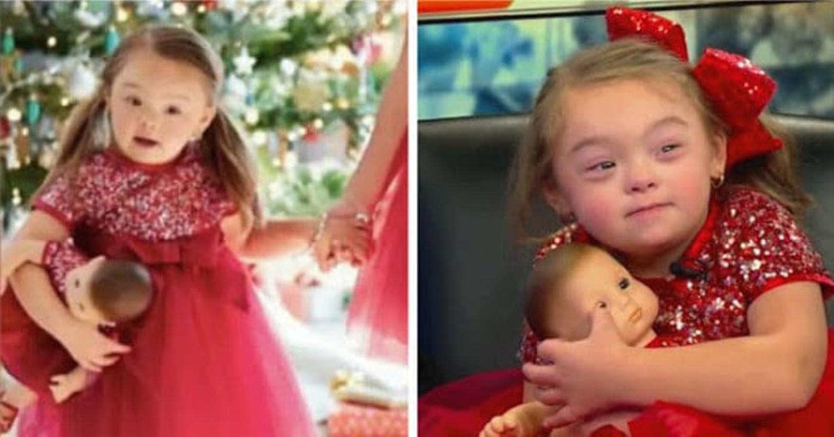 Menina com síndrome de Down se torna modelo de campanha de Natal